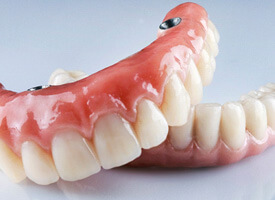 close up of implant dentures
