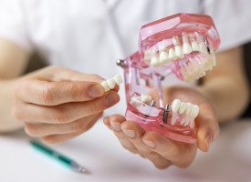 full and partial dentures